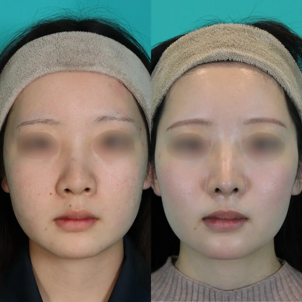 施術前後イメージ