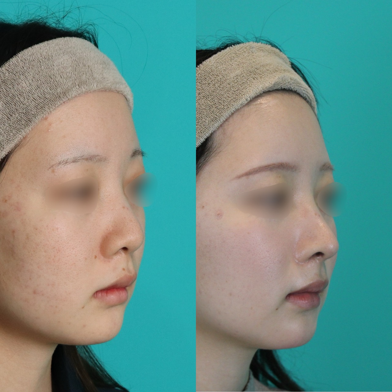 施術前後イメージ