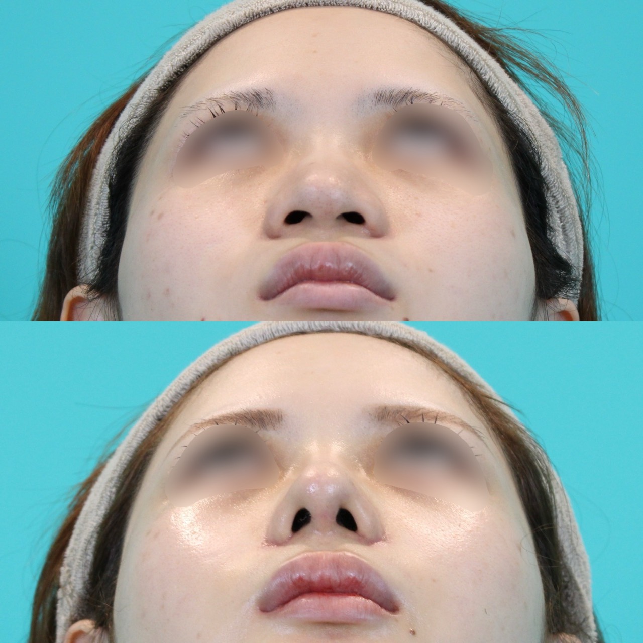 施術前後イメージ