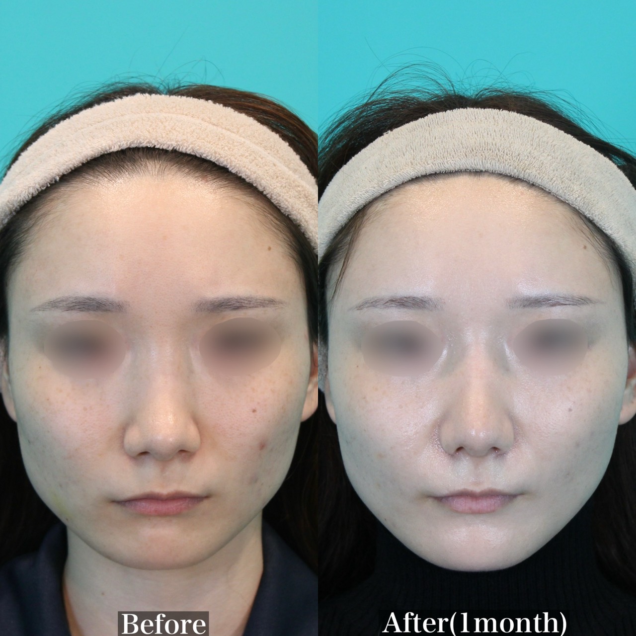 施術前後イメージ