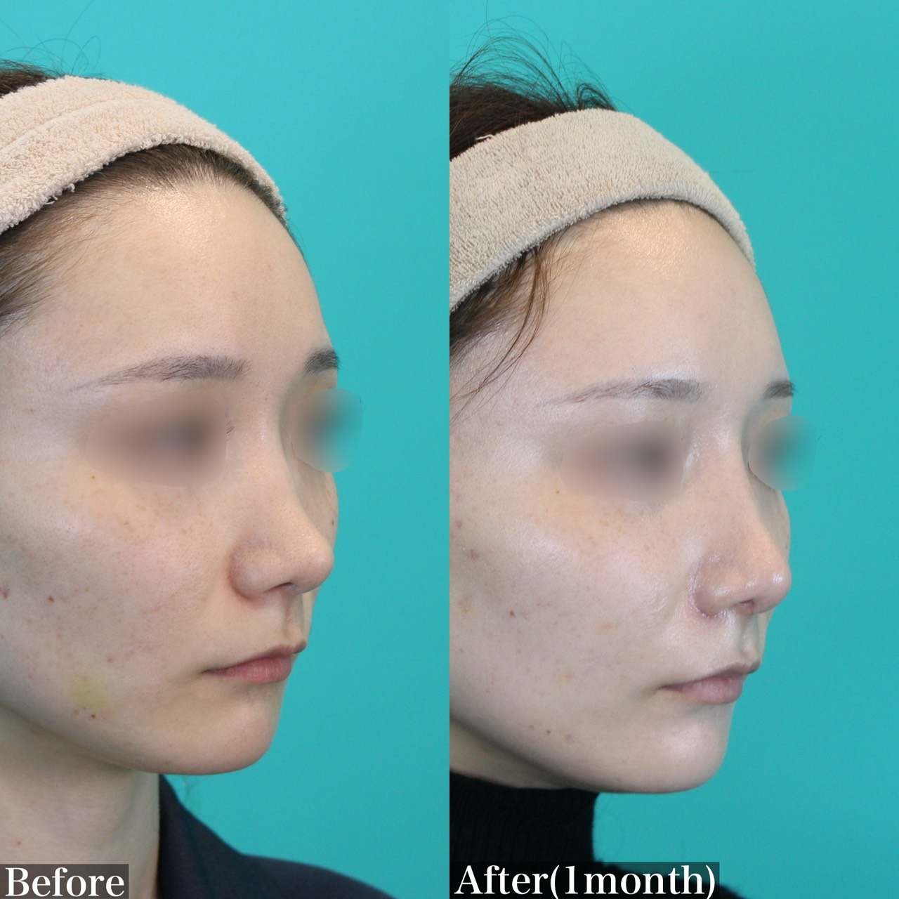 施術前後イメージ