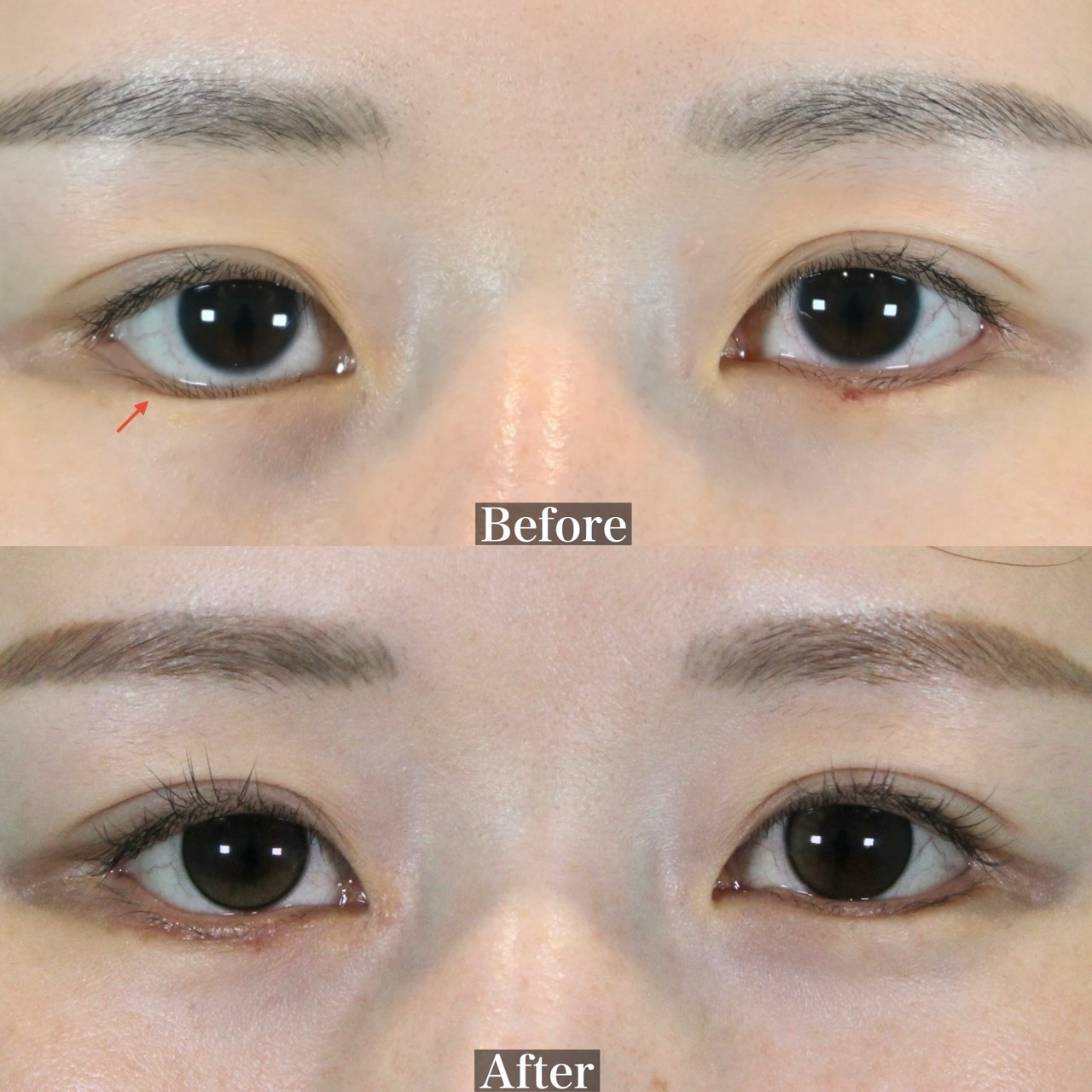 施術前後イメージ