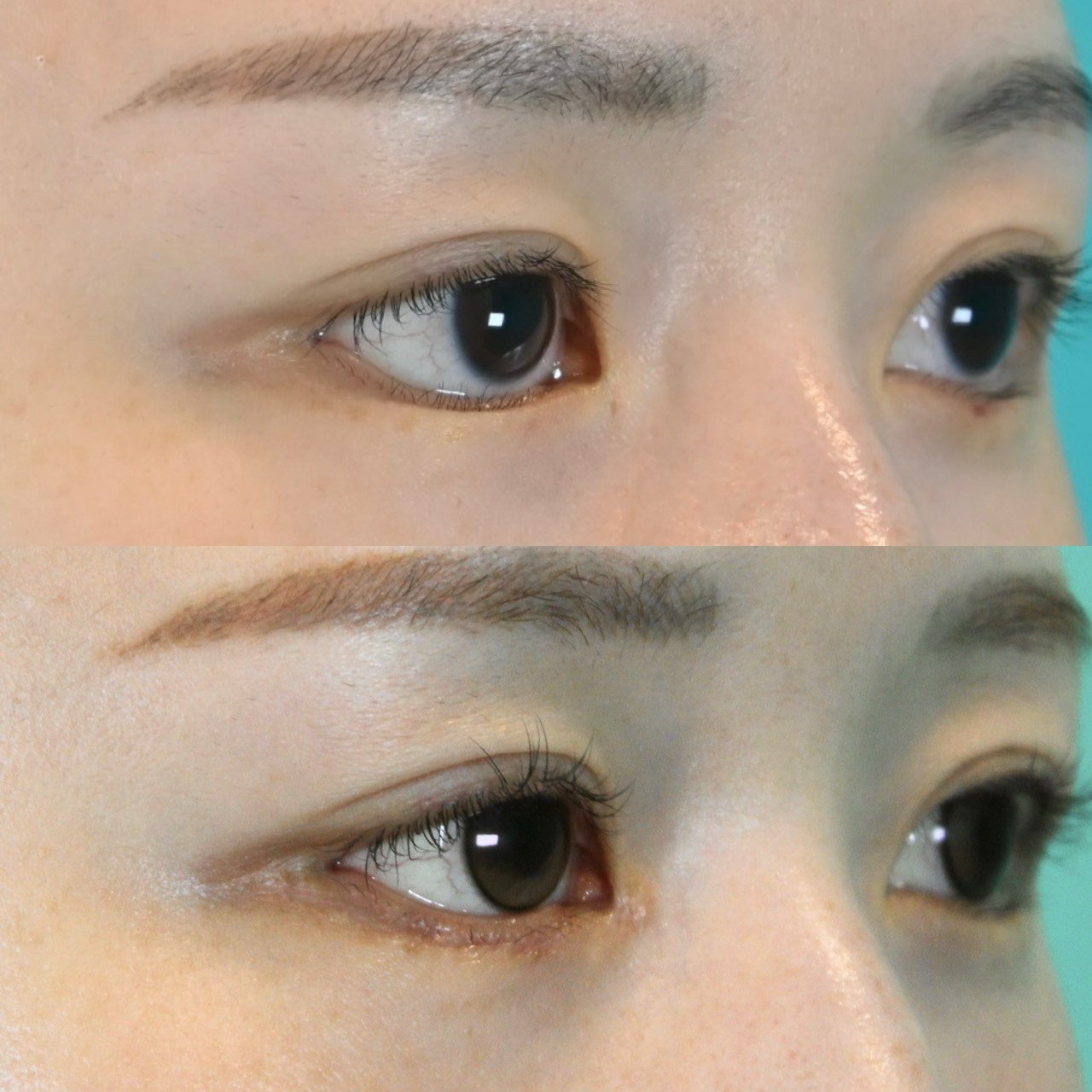 施術前後イメージ