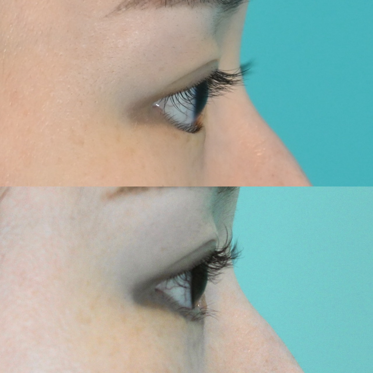 施術前後イメージ