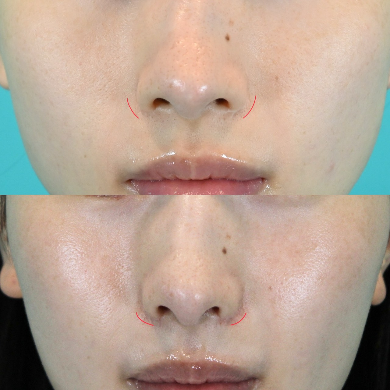 施術前後イメージ