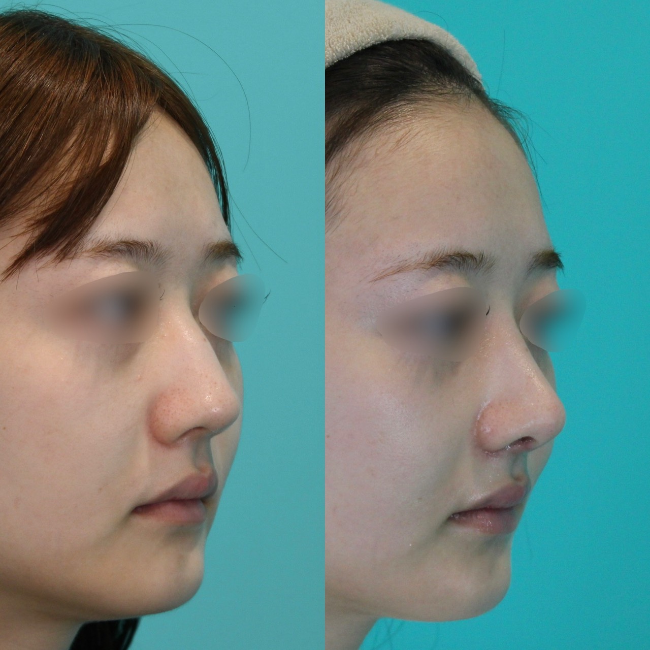 施術前後イメージ