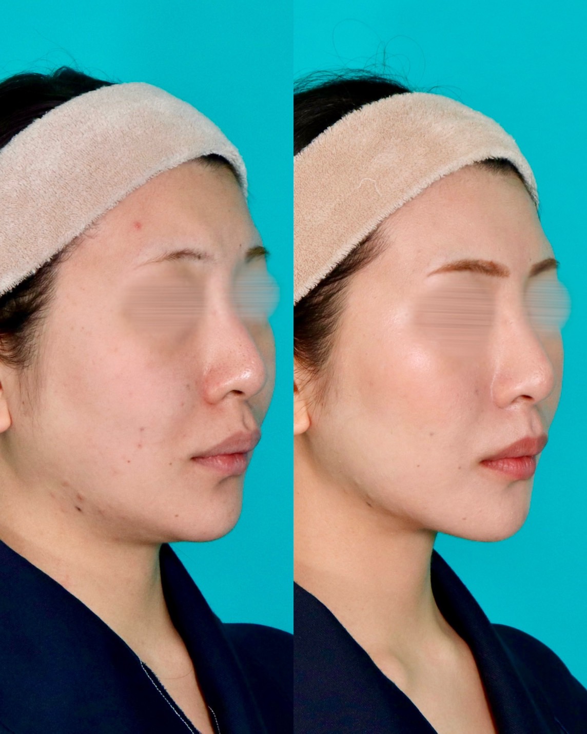 施術前後イメージ