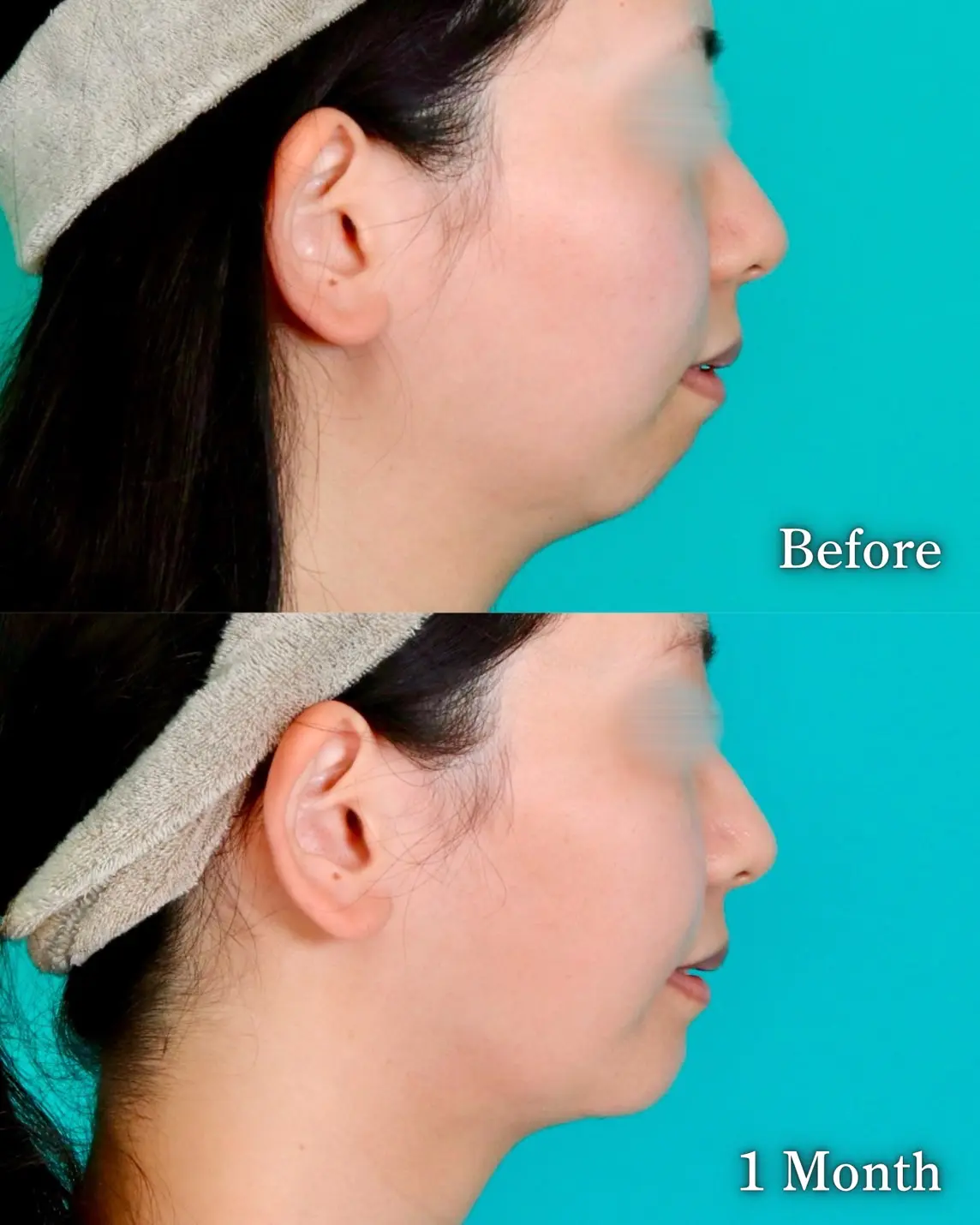 施術前後イメージ