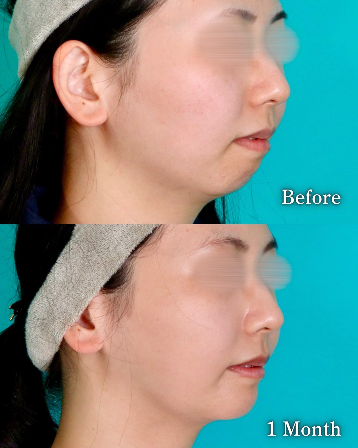 施術前後イメージ