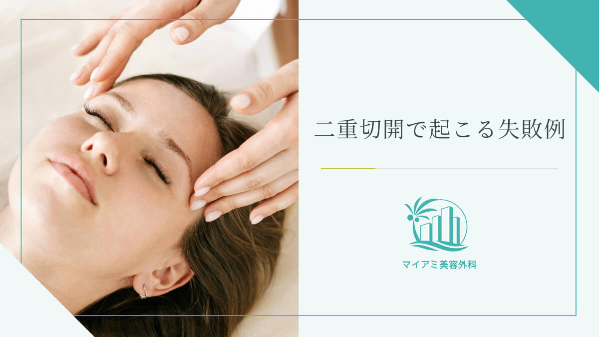 二重切開で起こる失敗例