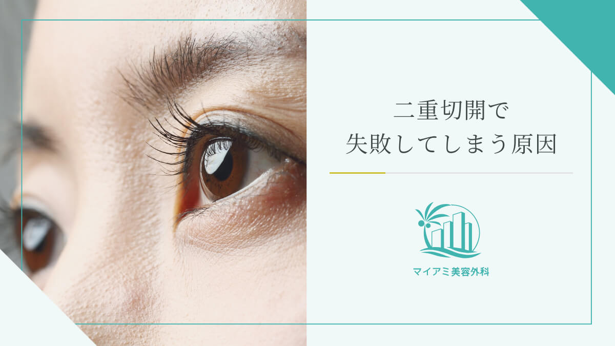 二重切開で失敗してしまう原因