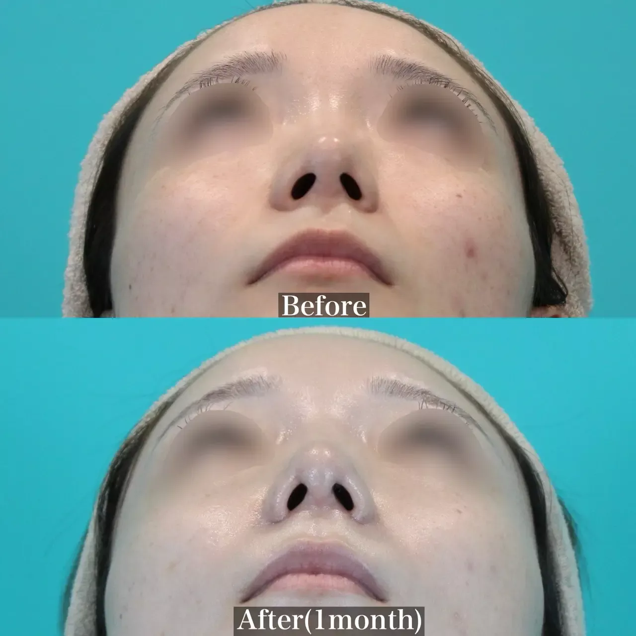 施術前後イメージ