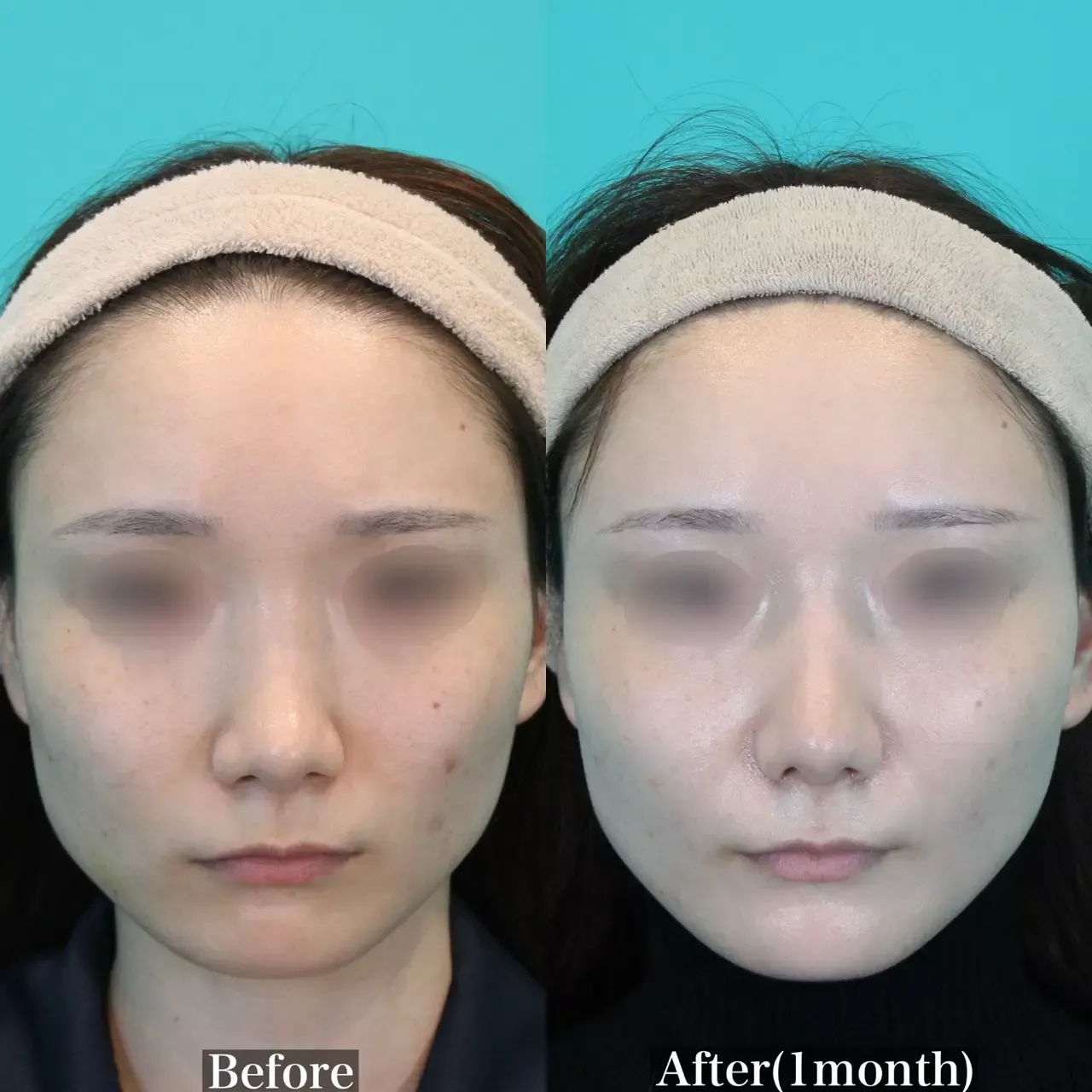 施術前後イメージ