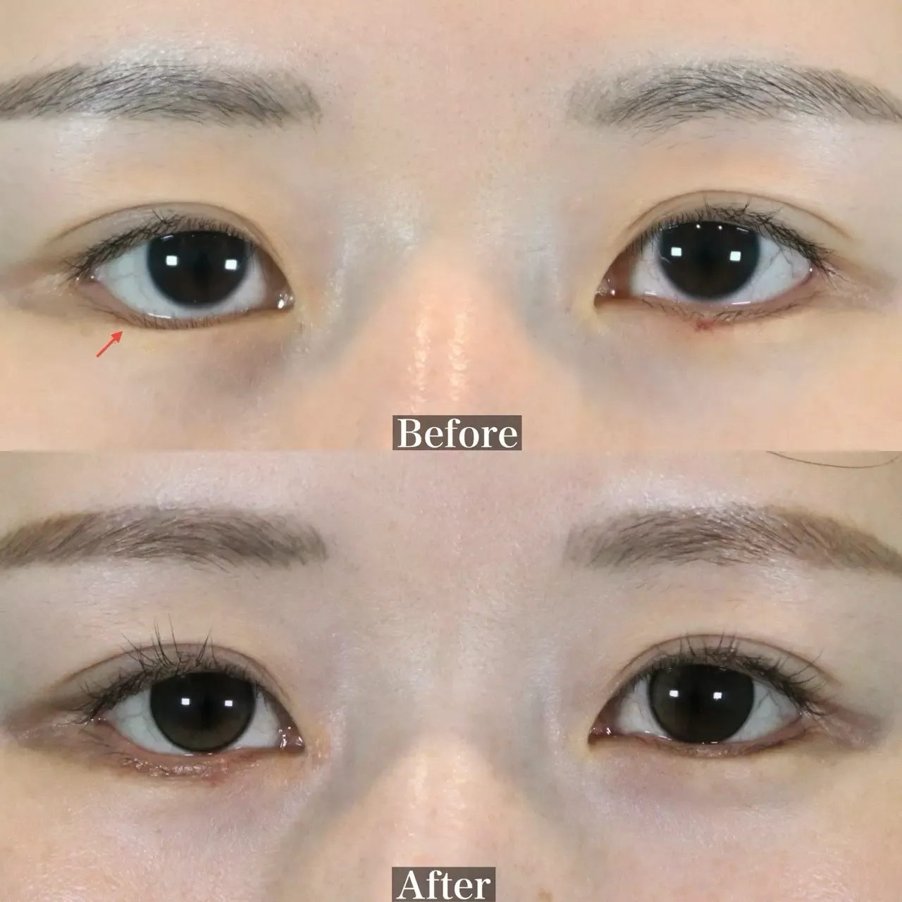 施術前後イメージ