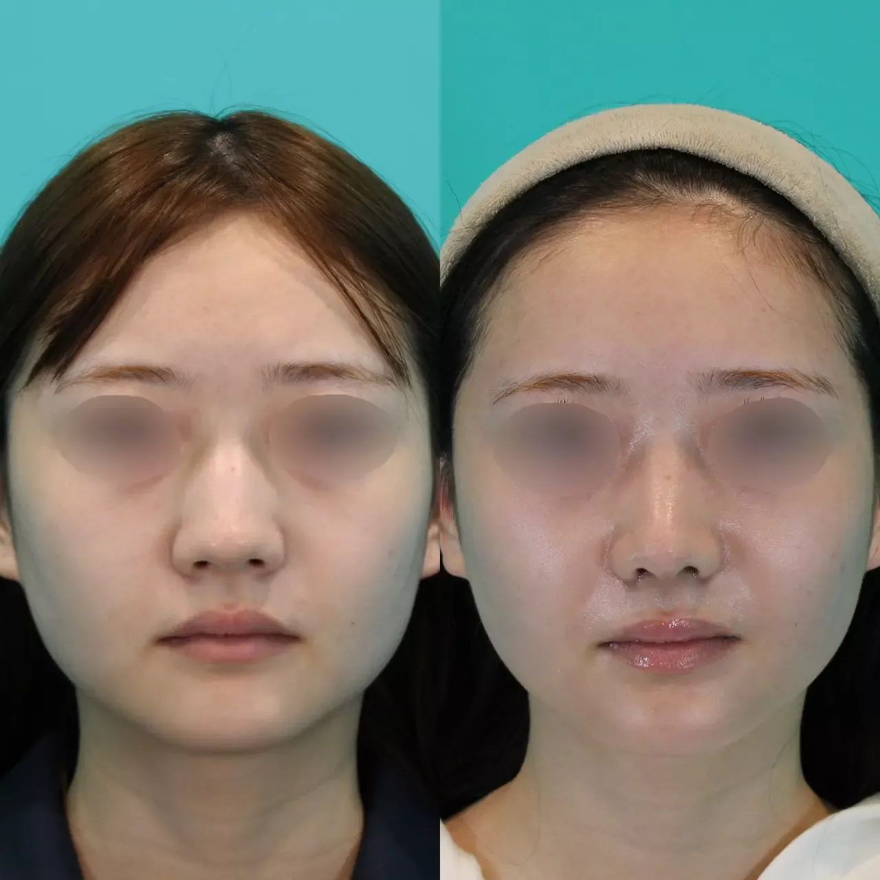 施術前後イメージ