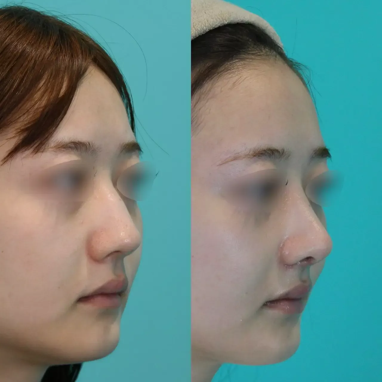 施術前後イメージ