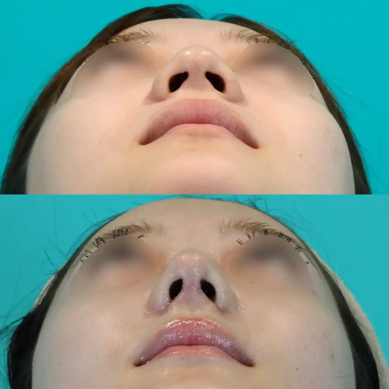 施術前後イメージ