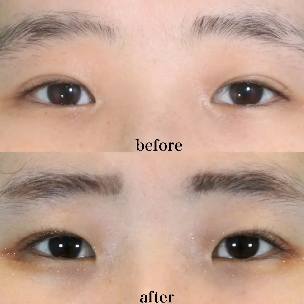 施術前後イメージ