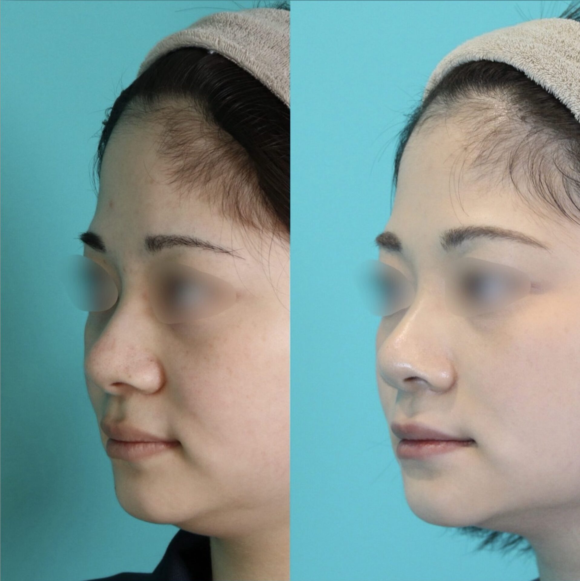 施術前後イメージ