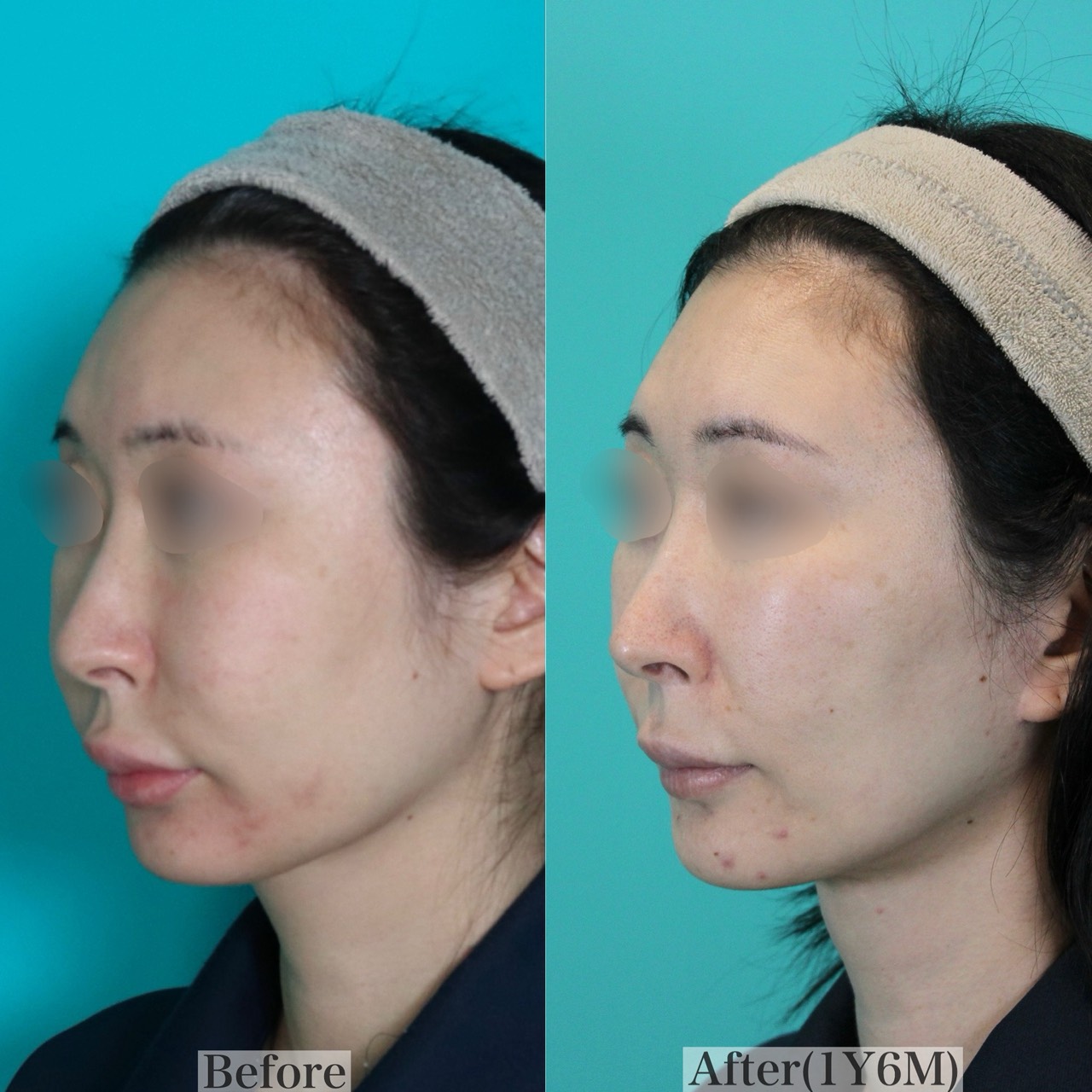 施術前後イメージ