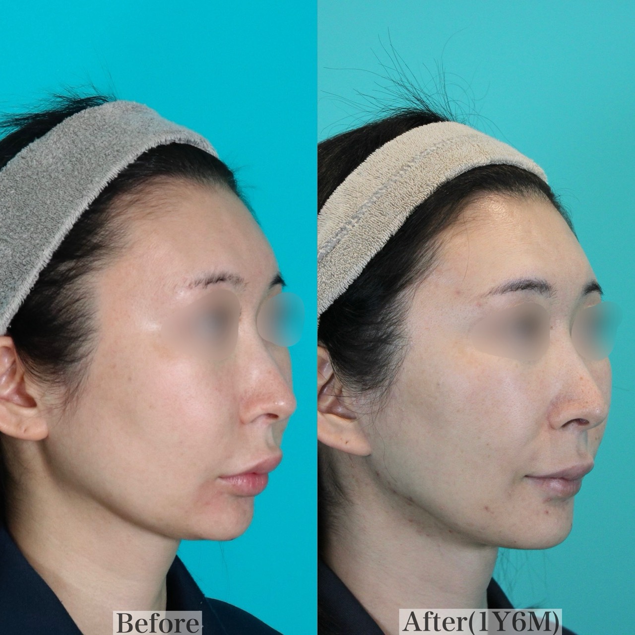 施術前後イメージ