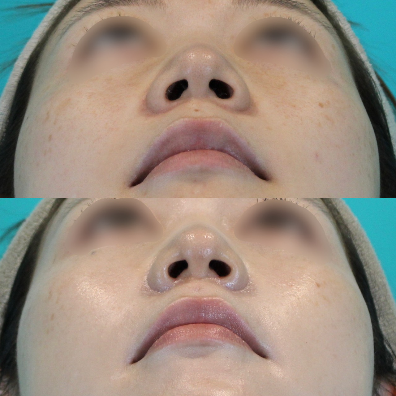 施術前後イメージ