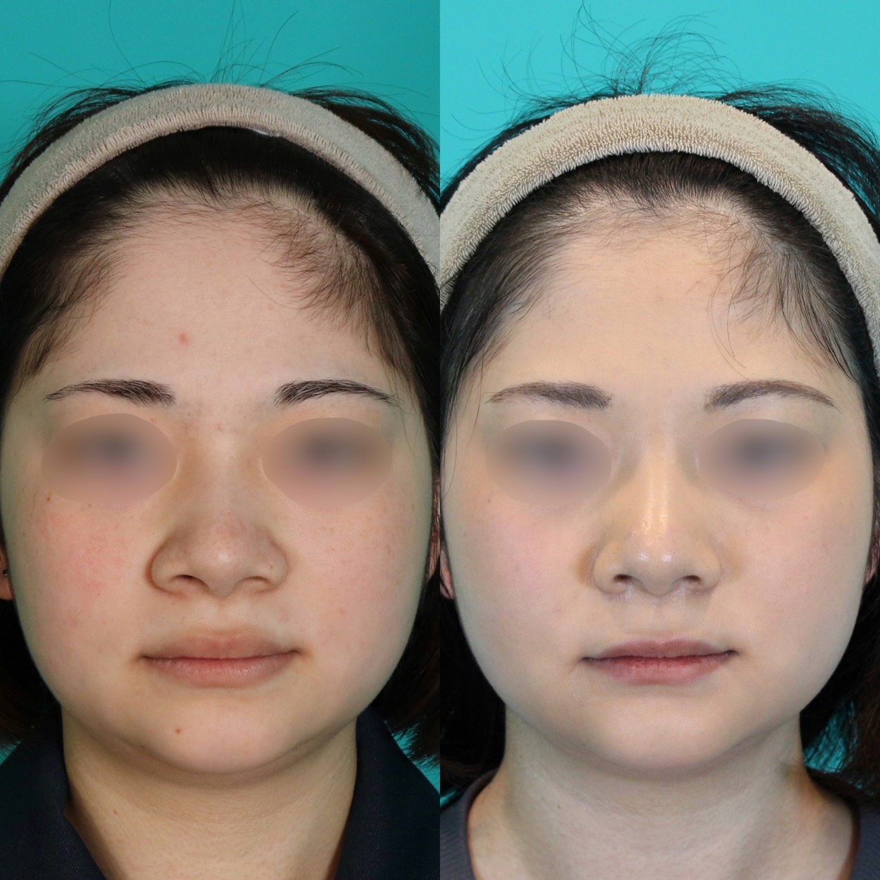 施術前後イメージ