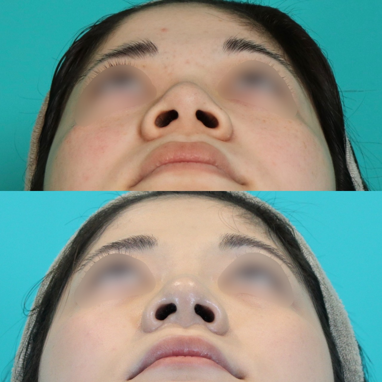 施術前後イメージ