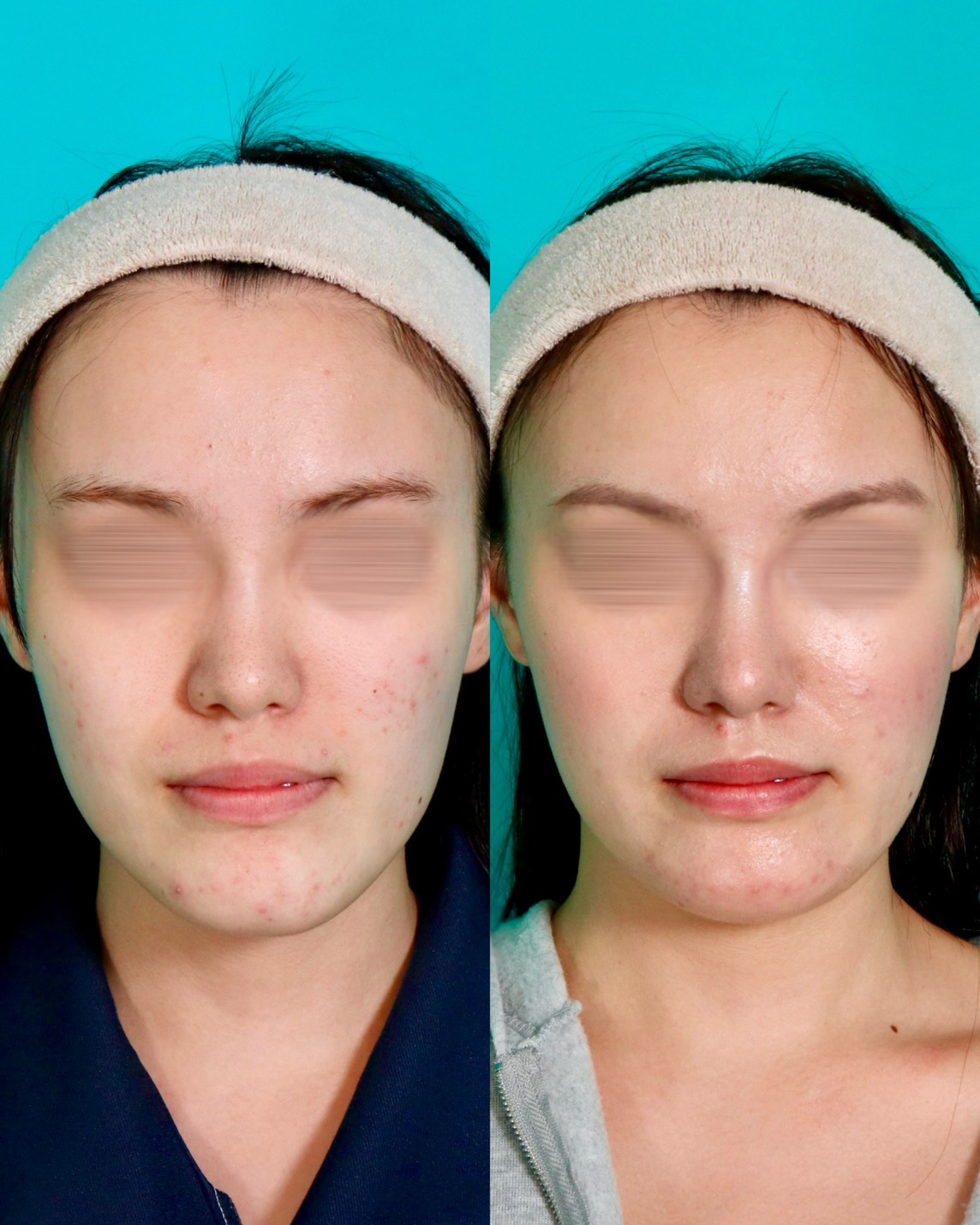 施術前後イメージ