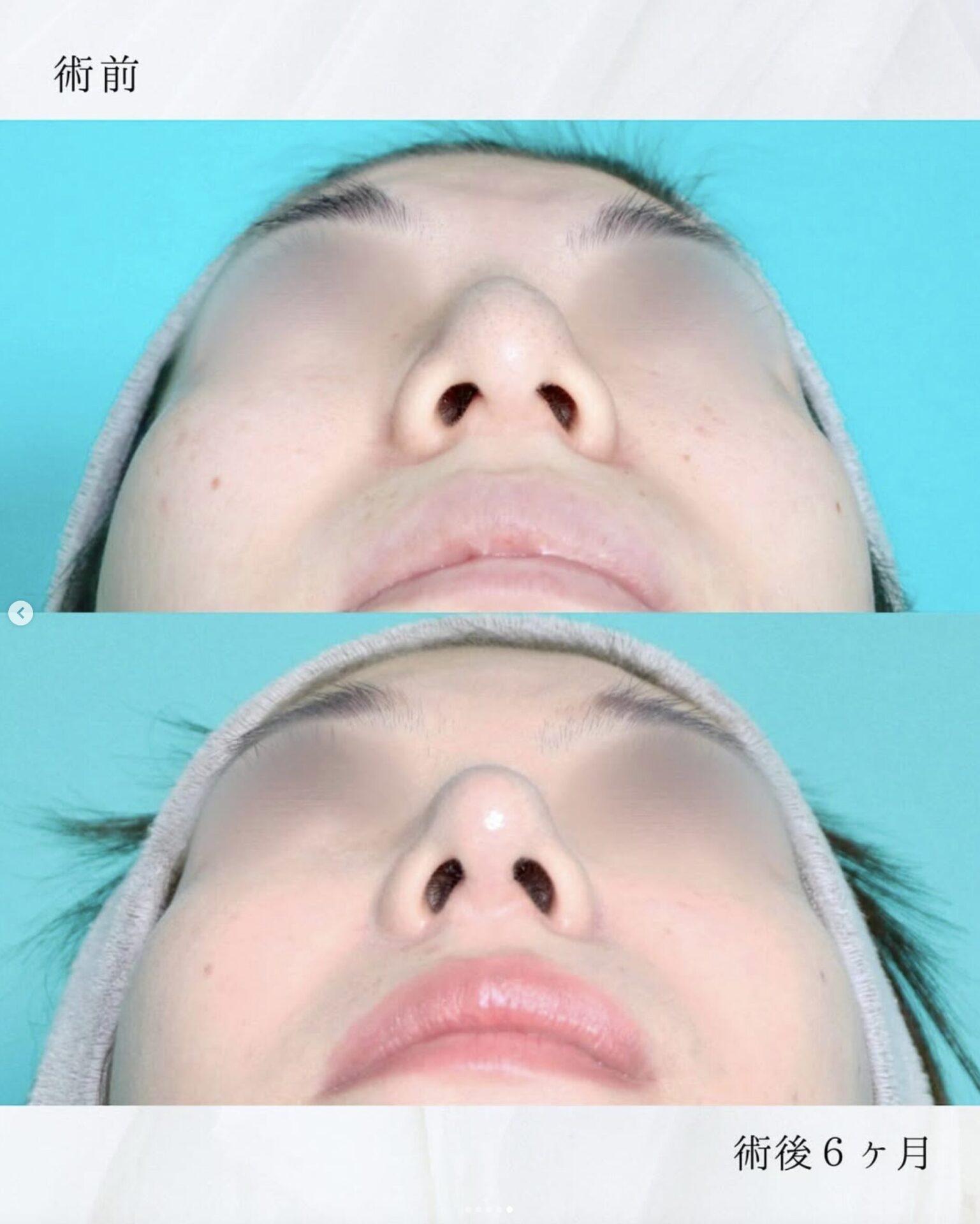 施術前後イメージ