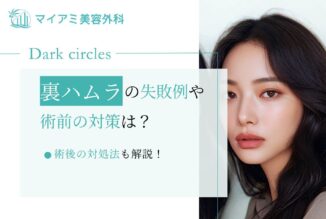 裏ハムラの失敗例や術前の対策・術後の対処法も解説！