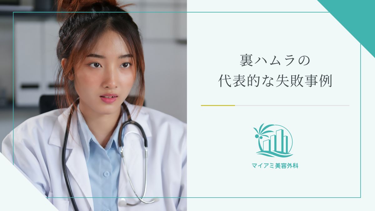 裏ハムラの代表的な失敗事例