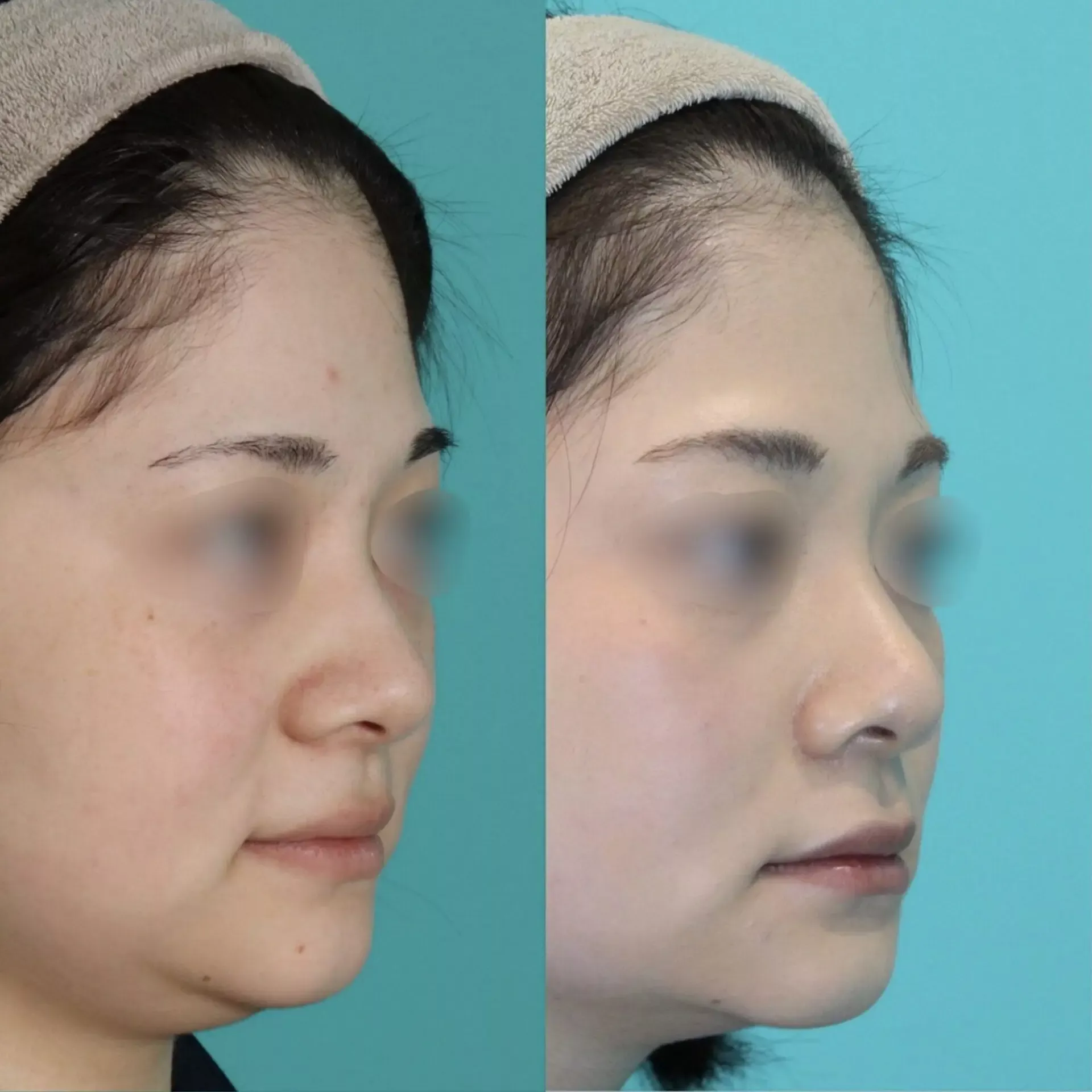 施術前後イメージ