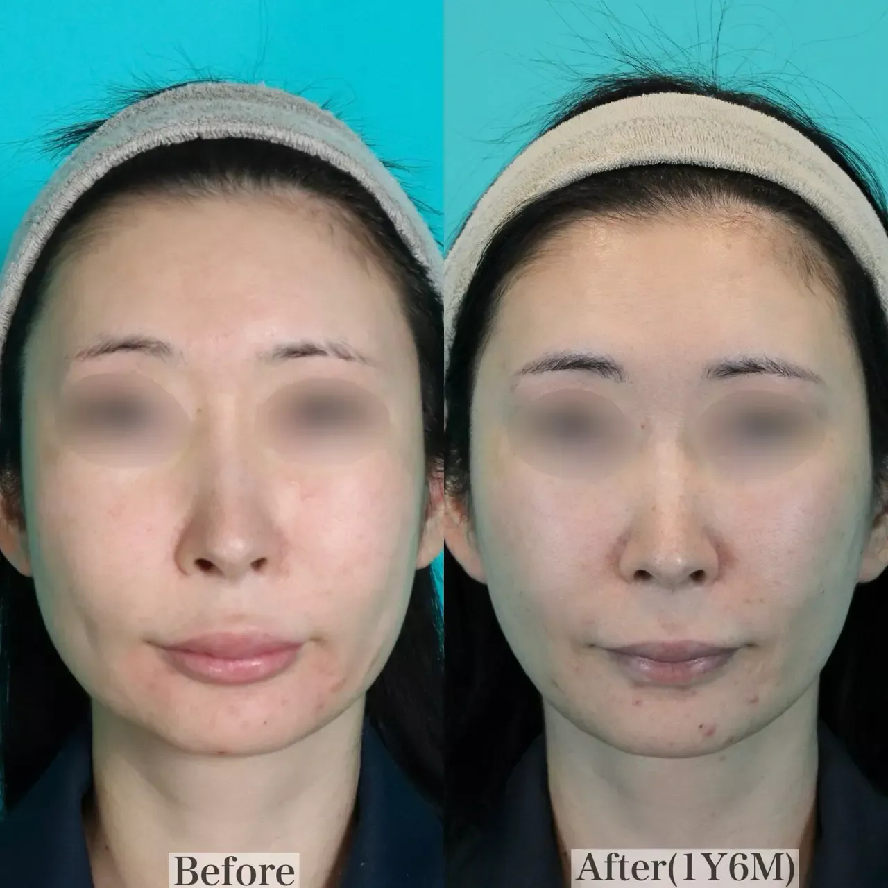 施術前後イメージ