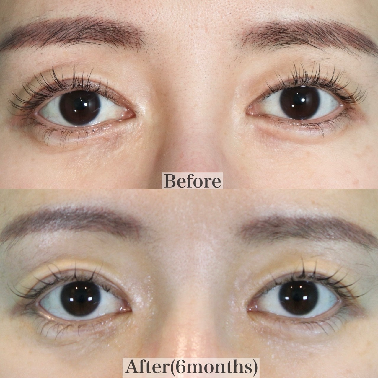 施術前後イメージ