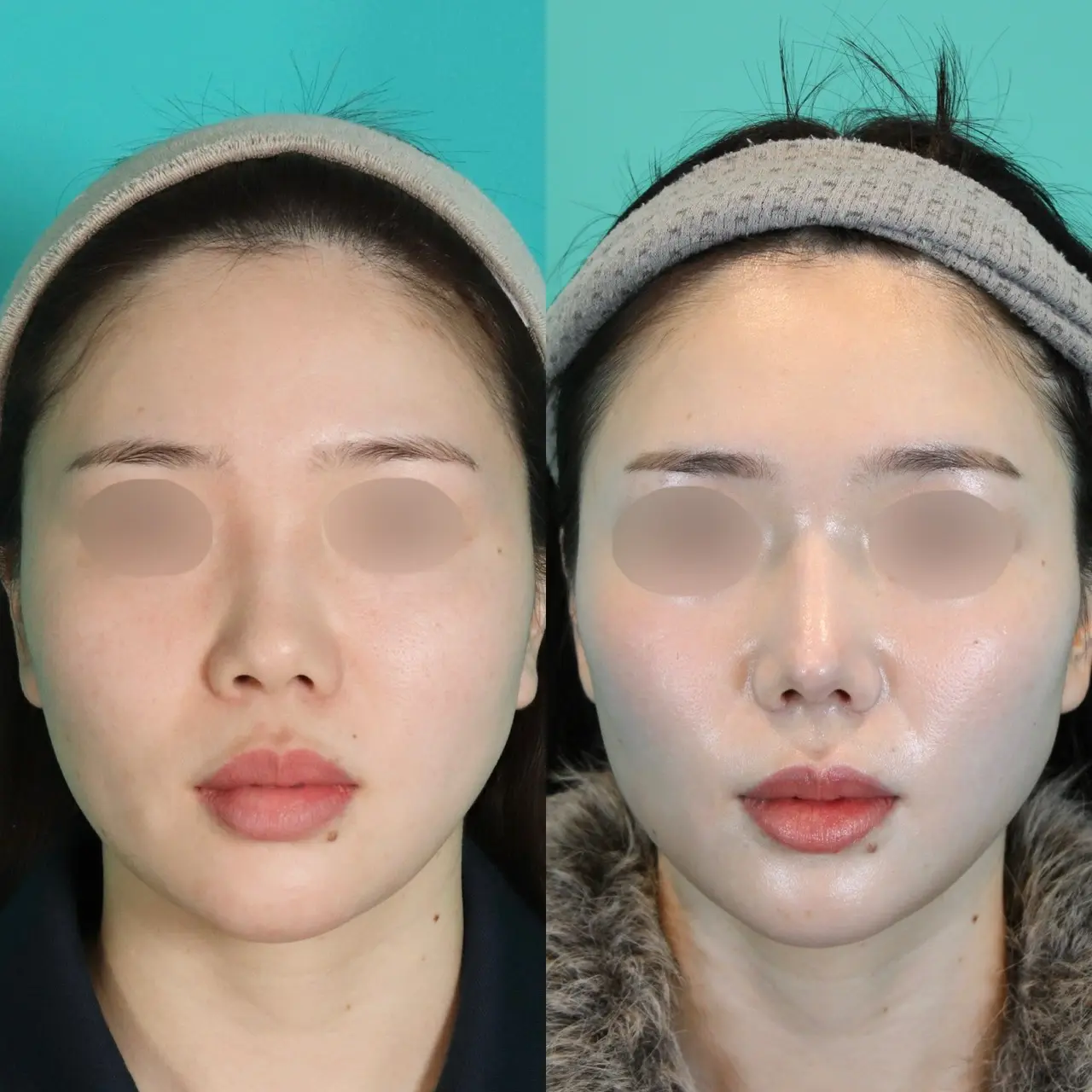 施術前後イメージ