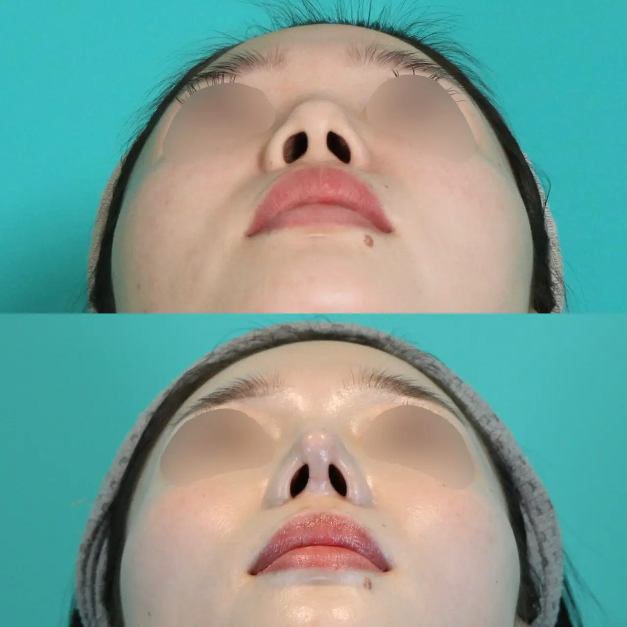 施術前後イメージ