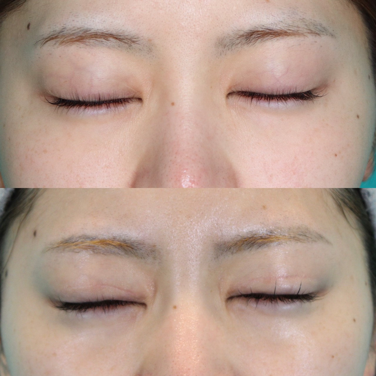 施術前後イメージ