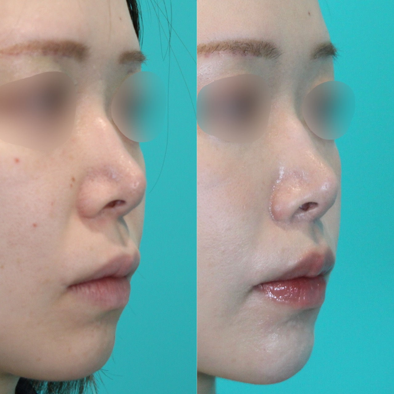 施術前後イメージ