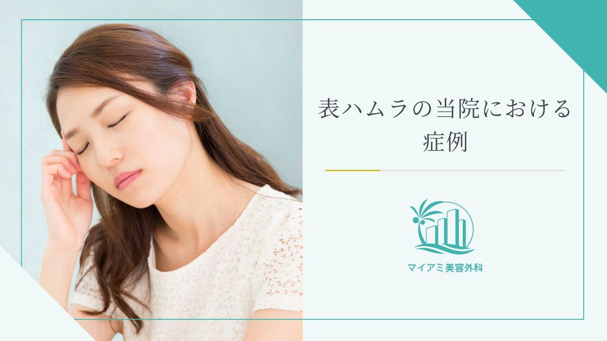 表ハムラの当院における症例