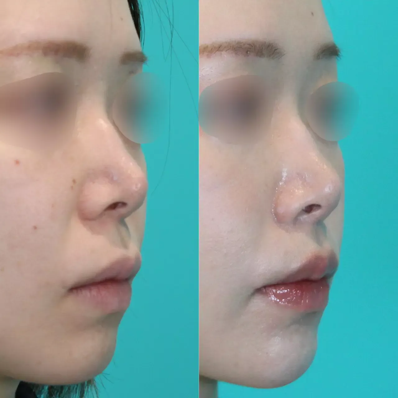 施術前後イメージ