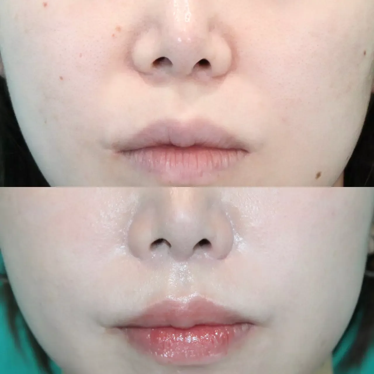 施術前後イメージ