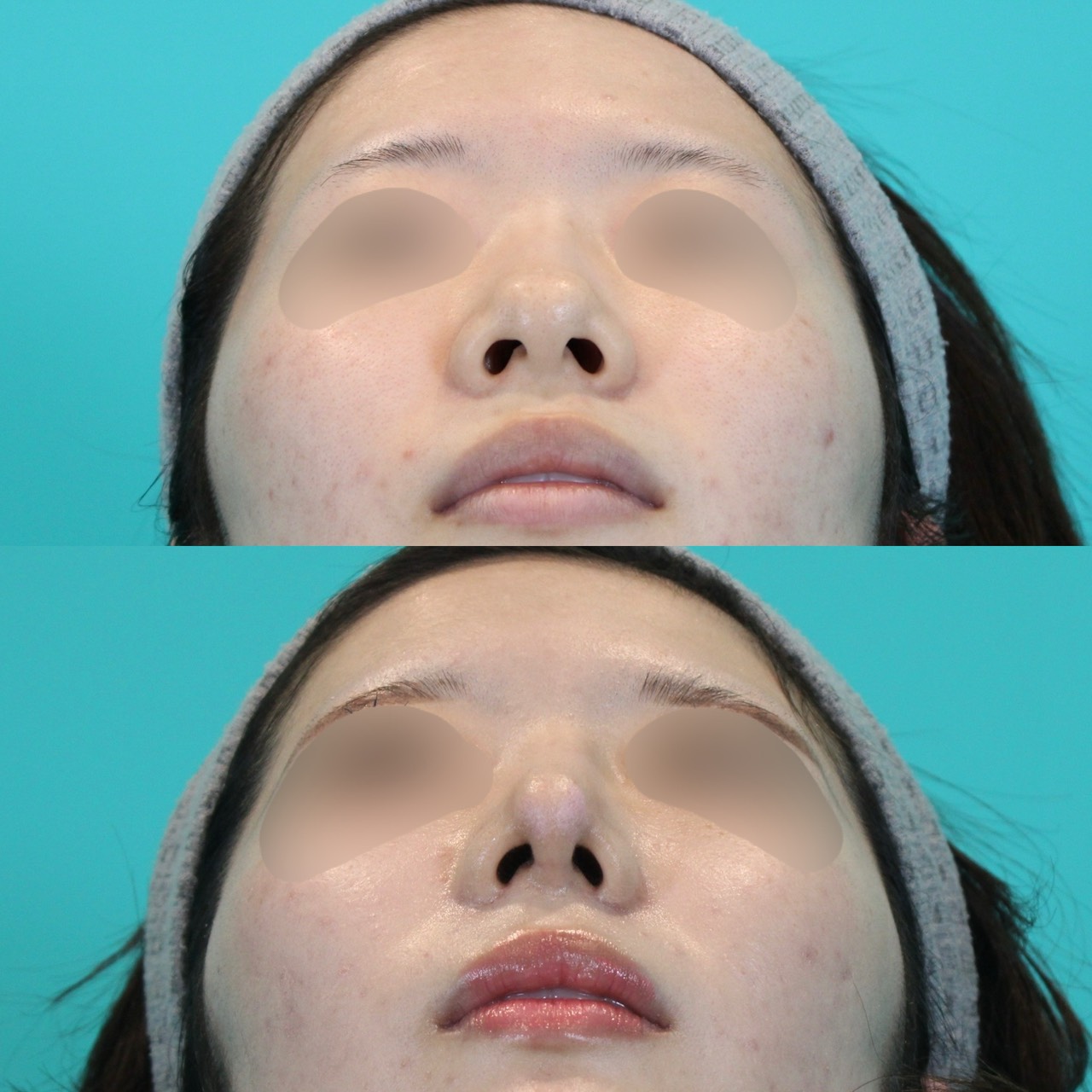 施術前後イメージ