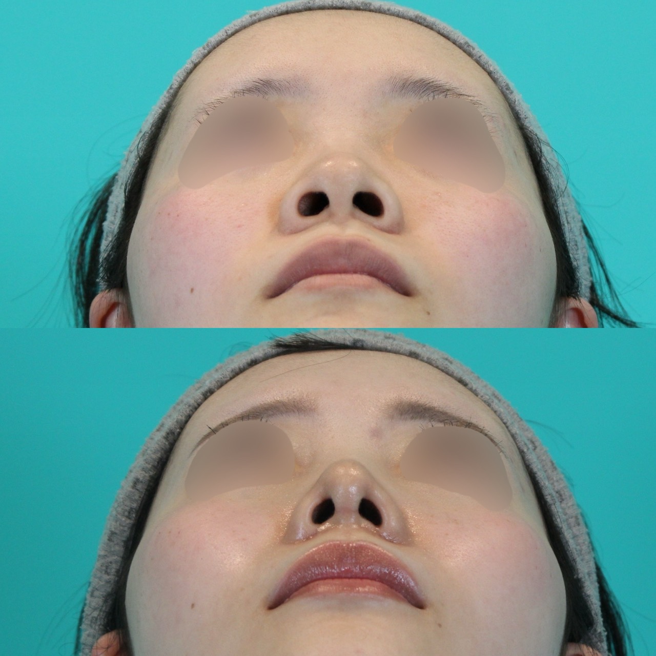 施術前後イメージ