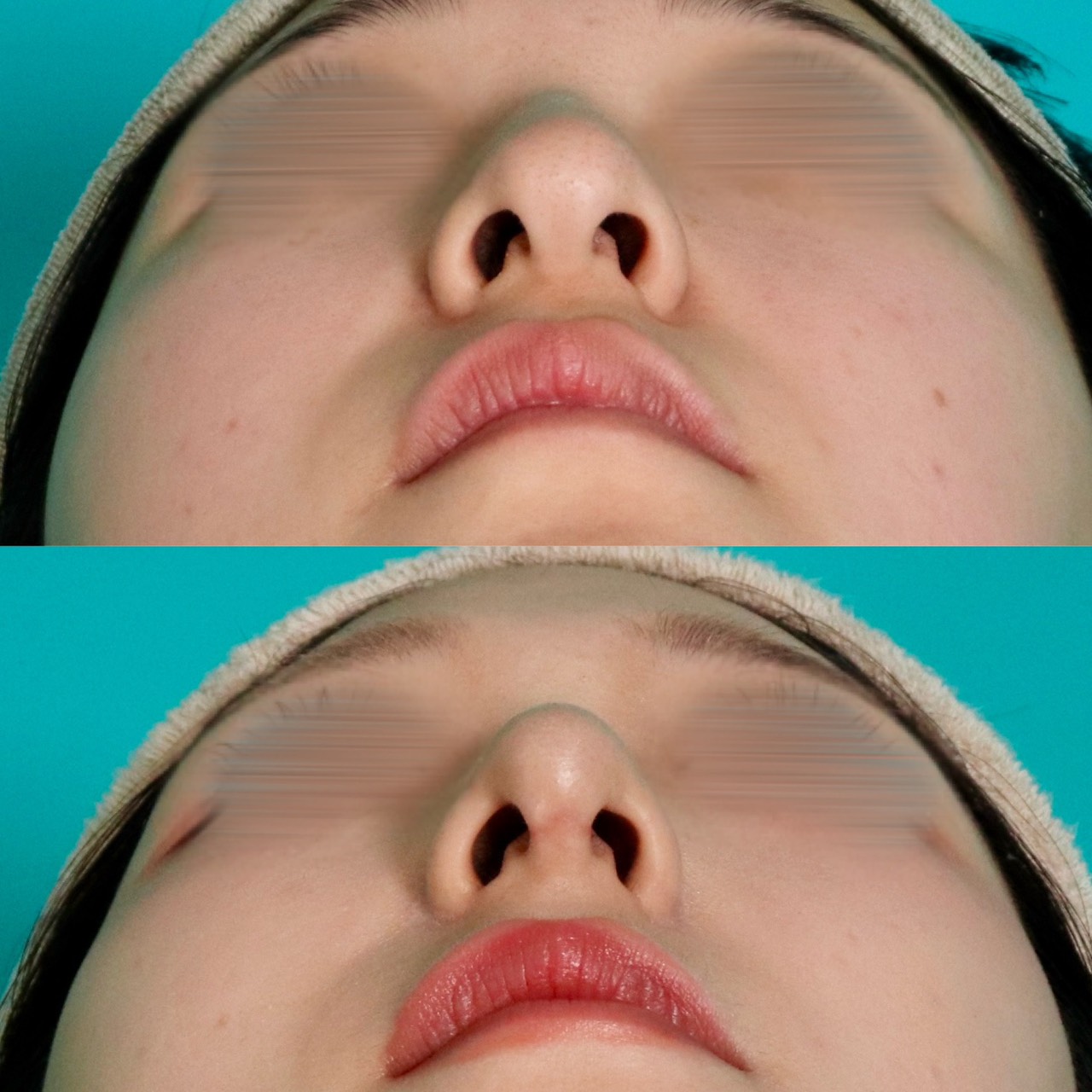 施術前後イメージ