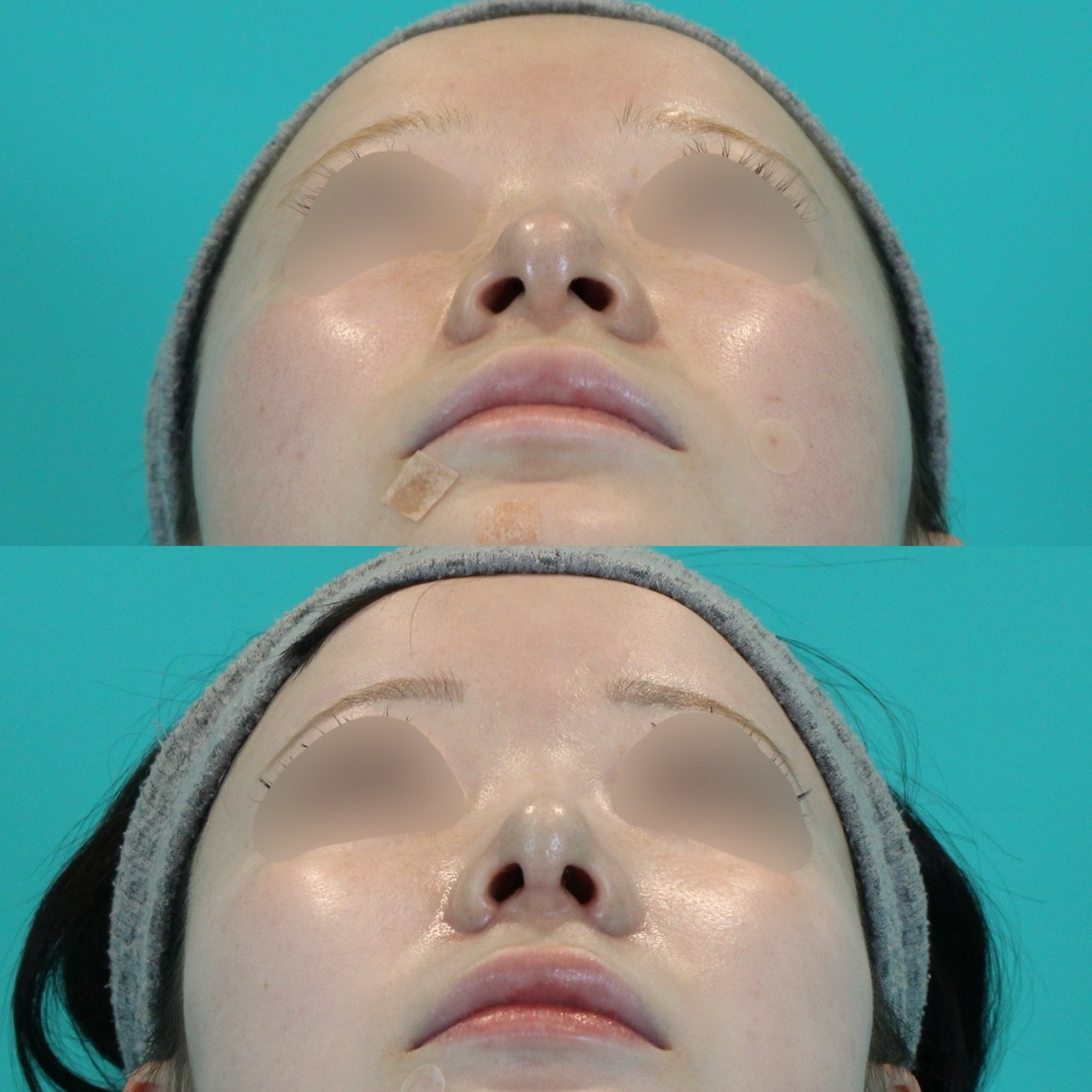 施術前後イメージ