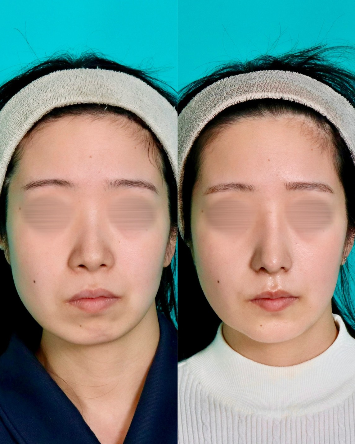 施術前後イメージ