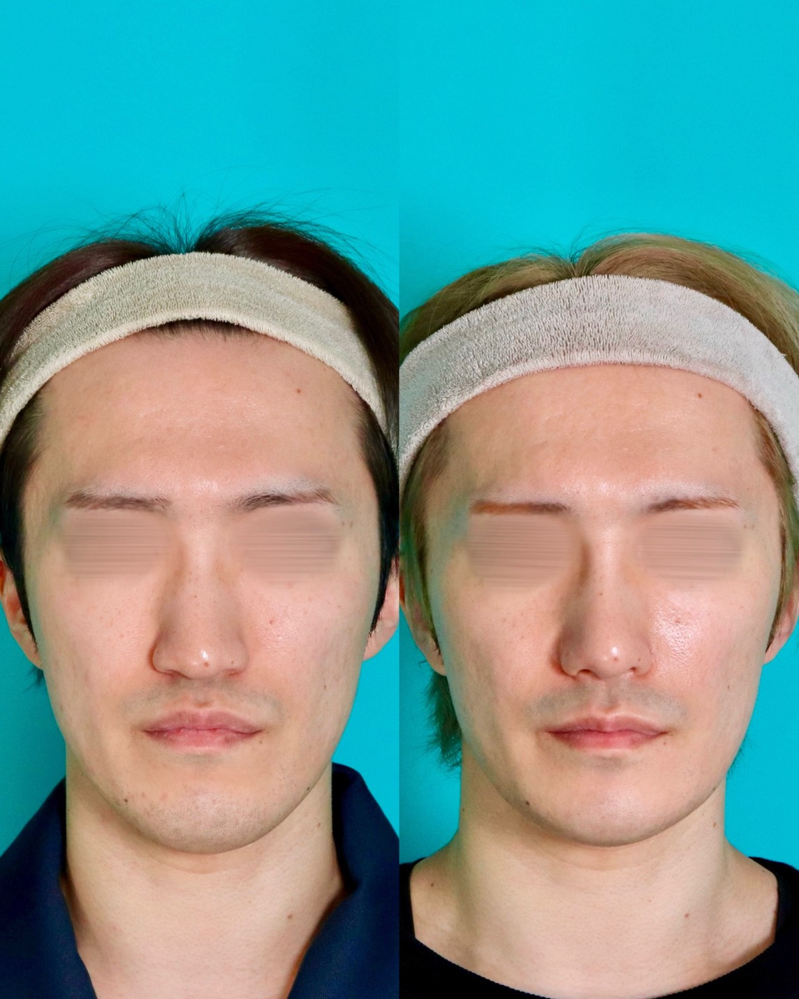 施術前後イメージ