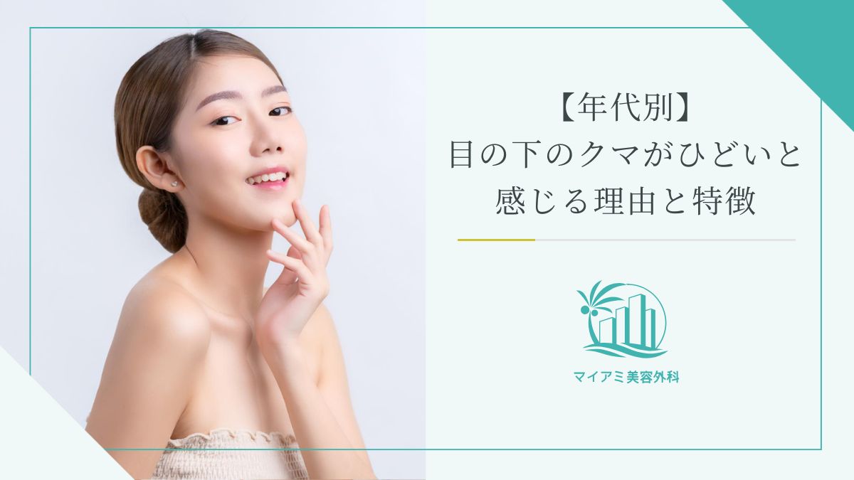 【年代別】目の下のクマがひどいと感じる理由と特徴