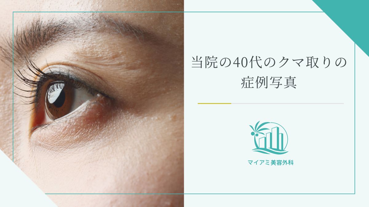 当院の40代のクマ取りの症例写真